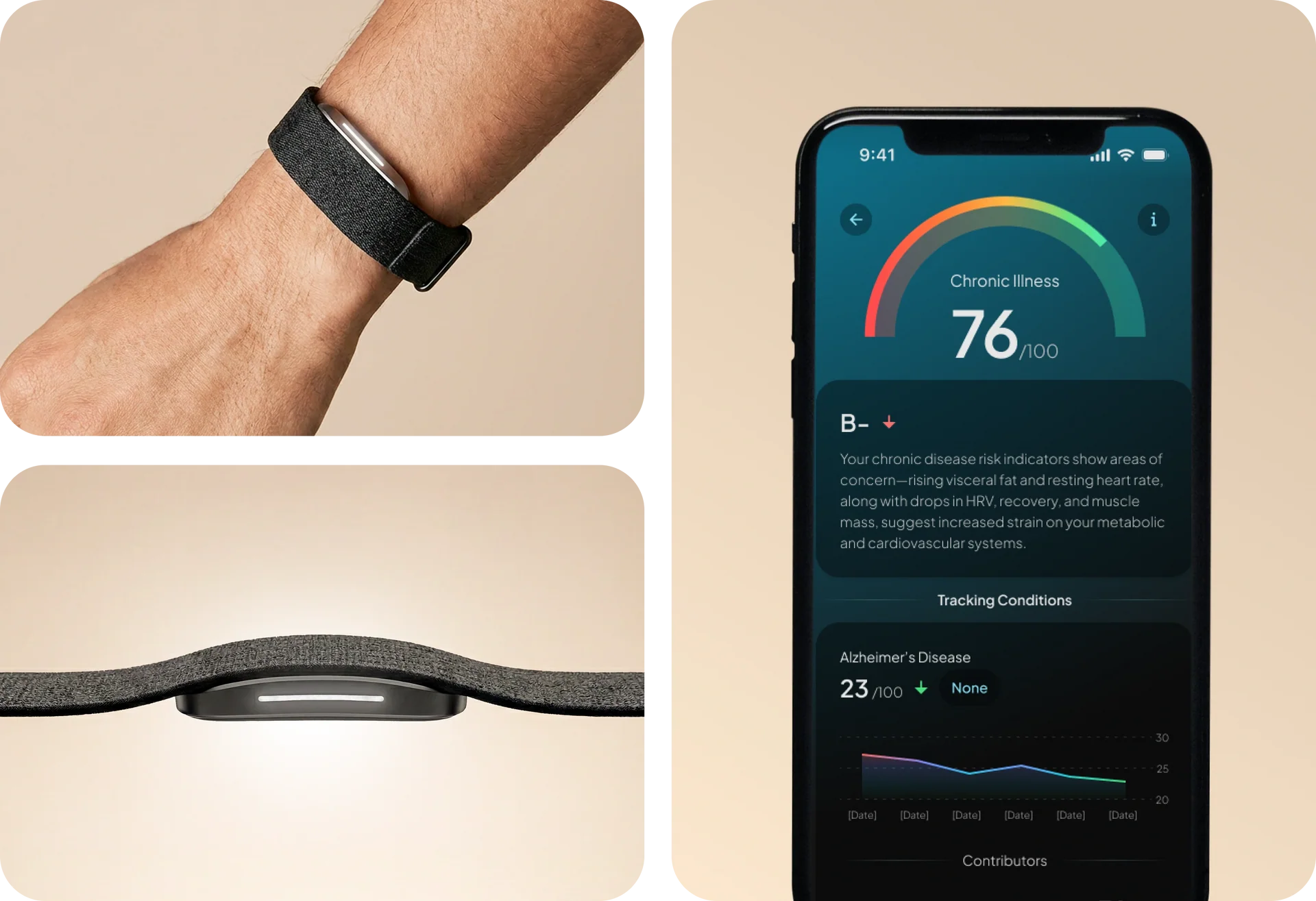 Hume Band 2.0 worn on a wrist next to a phone showing the app's chronic illness risk score